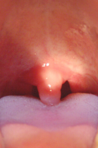 function of uvula 